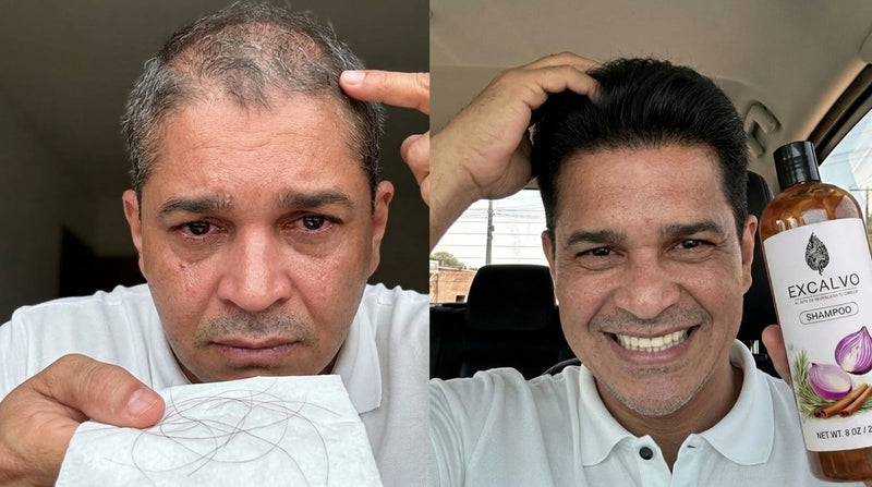 Antes y después — Miguel F., 32