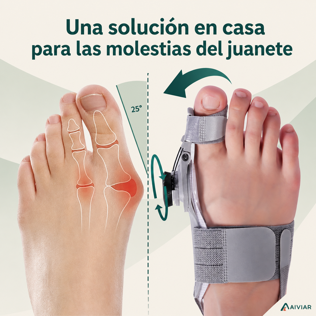 Corrector Articulado para Juanetes- ALIVIAR